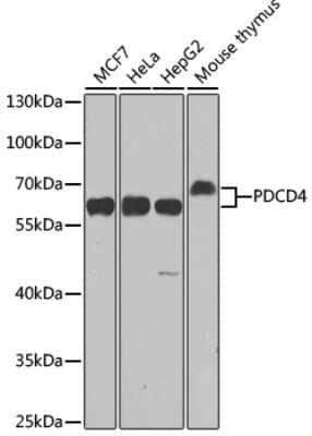 Western Blot: PDCD4 Antibody [NBP3-03401] - Western blot analysis of extracts of various cell lines, using PDCD4 antibody (NBP3-03401) at 1:1000 dilution. Secondary antibody: HRP Goat Anti-Rabbit IgG (H+L) at 1:10000 dilution. Lysates/proteins: 25ug per lane. Blocking buffer: 3% nonfat dry milk in TBST. Detection: ECL Enhanced Kit. Exposure time: 90s.